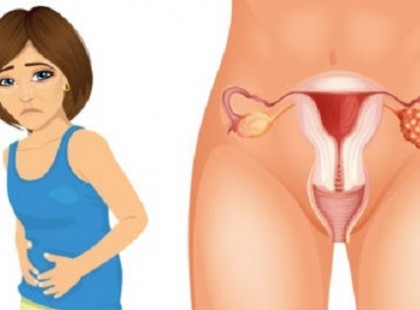 A petefészekrák 4 korai jele, amit minden nőnek ismernie kell!