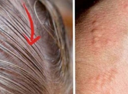 A pajzsmirigyprobléma 8 rejtett jele, amiről szinte senki sem vesz tudomást!