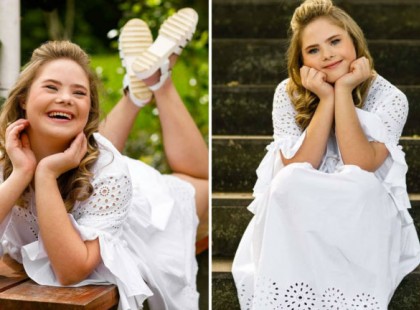 Down-szindrómás kislány ünnepelt modell lett <3