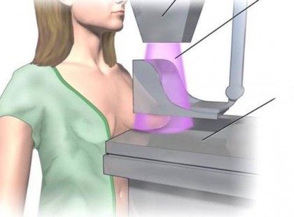 Egy orvos megdöbbentő őszintesége a mammográfiáról, amit minden nőnek el kell olvasnia!