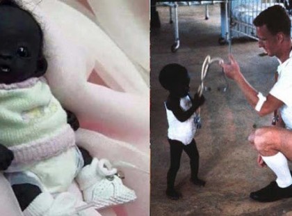 Ezt a csöppnyi ártatlan kisbabát eldobták szülei a korom fekete bőre miatt, de nézd meg 16 évesen!