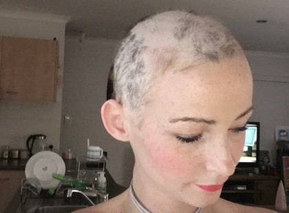 Egy éve távolították el a fiatal nő petefészkét, amikor újra kitapintott valamit a hasán. Ledöbbent, amikor kiderült, mi az