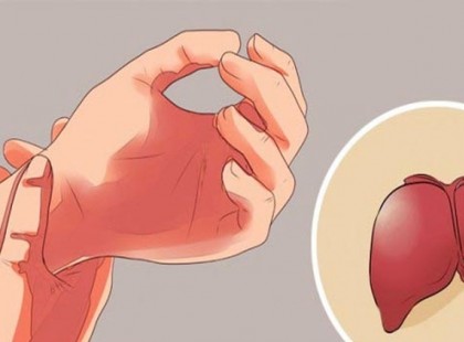 A máj nem jelzi, ha megbetegszik, de van 5 tünet, ami jelezheti a bajt