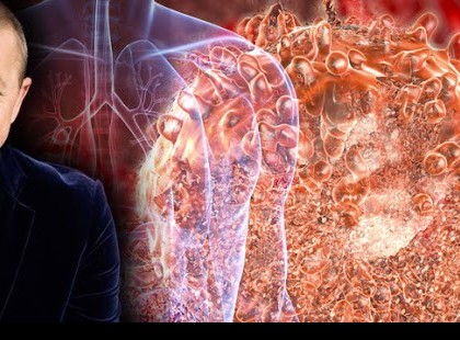 Dr. Lenkei Gábor rájött, hogy mi a rák VALÓDI oka! Ha ezt tudnák az emberek, senki se lenne beteg! Szerinte éppen ebben rejlik a rákipar ereje. Amit az onkológusok nem mondanak el…