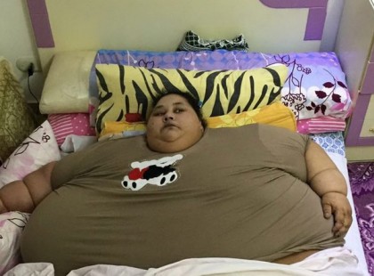 Elhagyhatta a kórházat: 325 kilót fogyott a világ legkövérebb nője - fotó