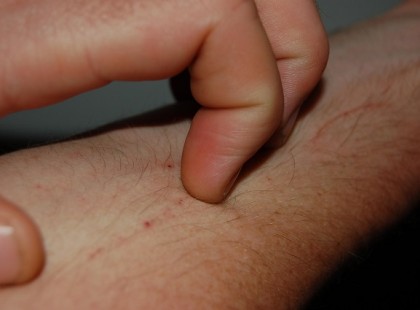 10 jele annak, hogy daganatos sejtek lehetnek a szervezetedben! 10 jele annak, hogy daganatos sejtek lehetnek a szervezetedben!