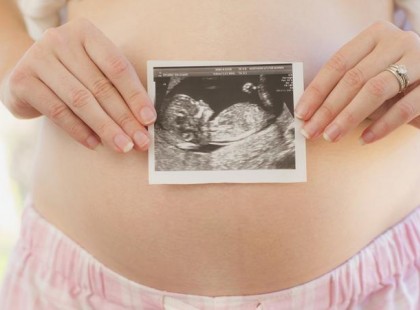 20 hetes terhes voltam, amikor az orvos azt mondta, hogy válasszak az életem, vagy a baba élete között!Elmondom, miért döntöttem úgy, ahogy!