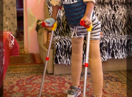 Összeszorul a szív: műlábra gyűjt Viktorka az amputált kisfiú