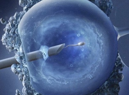 Létezik az,hogy valakinek két anyja van?