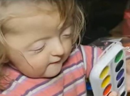 Kirúgták a 2 éves kislányt a bölcsiből, mert csúnyácska és a nevelőnők szerint a többi gyereket megijesztené…