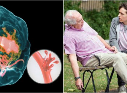 Miért zsibbadnak kezeink: hét ok, ami rávesz arra, hogy az egészséggel foglalkozz