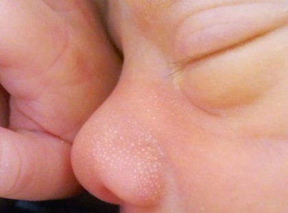 Most kaptuk a hírt: halott csecsemőt találtak Tótkomlóson A bozótosban, zacskóba rejtve találták a csecsemőt.