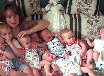 22 évesek a világ első túlélő hetes ikrei, így néznek ki felnőtten!