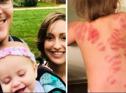 Hazavitte a gyereket a bölcsiből és így nézett ki a háta…