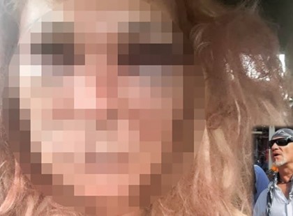 Nagyon rossz hírek érkeztek a bujáki megvert Nőről