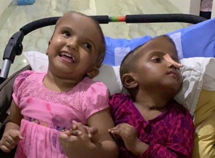 Csókay András: Csoda hogy életben van a szétválasztott ikerpár fiú tagja