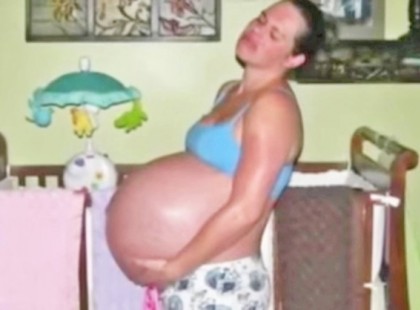 Ami ennek a nőnek a hasában volt, még az orvosokat is sokkolta. Senki sem számított erre.