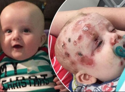 EZ AZ ÉDESANYA KISFIA EGÉSZSÉGE ÁRÁN TUDTA MEG, MIÉRT FELELŐTLEN EGYRE TÖBB SZÜLŐ!