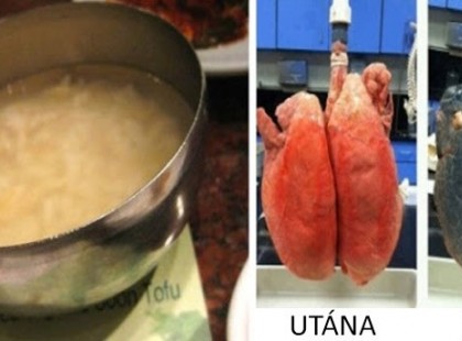 Ez 3 nap alatt kipucolja a tüdőd, akkor is, ha több mint 5 éve dohányzol!