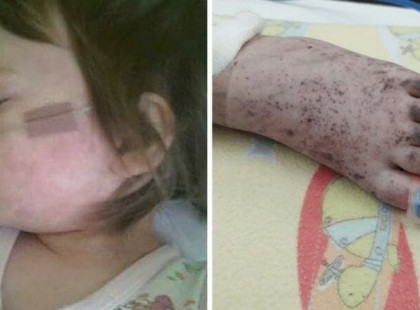 Az anya meglátja a kék foltokat lánya lábán, és tudja, hogy mindennek vége. A kórház nagyot hibázott