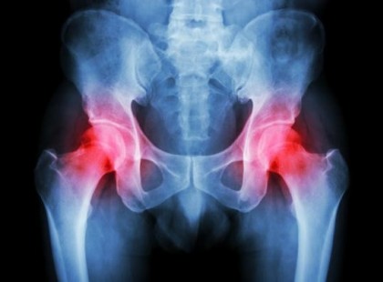 Így oldhatod ki gyorsan a húgysavat a testrészeidből, hogy megszűnjön a köszvény és az ízületi fájdalom.