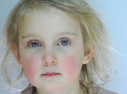 Kérünk egy megosztást!Eltűnt egy ötéves kislány,harmadik napja nem találják!