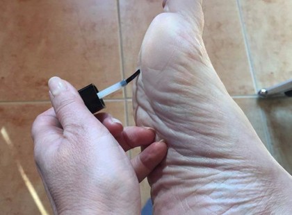 Körömlakkal kente be a talpát. Ha megtudod, miért, te is kipróbálod majd!