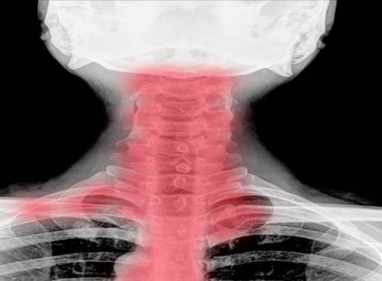 Szédülni szoktál? Zsibbadnak a végtagjaid? Nagyon rossz hírünk van!