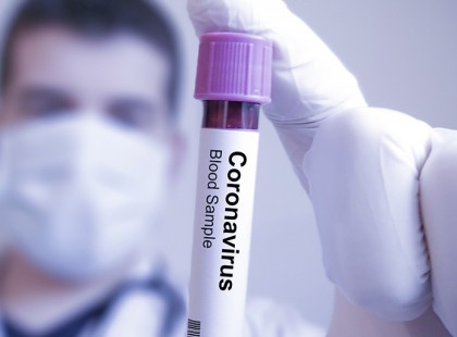 FONTOS! Súlyos és nagyon szigorú intézkedések léptek életbe az IDŐSEK védelmére! EZT KÖTELEZŐEN BE KELL TARTANI EZENTÚL >>>>