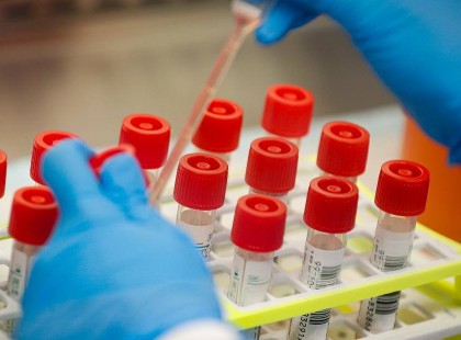 Ma jelentették be : A magyar lakosság EZEN RÉSZÉT MÁTÓL KÖTELEZŐEN szűrik koronavírusra! RAJTUK mától kötelezően elvégzik a gyorstesztet! ERRE KÉSZÜLJÖN!