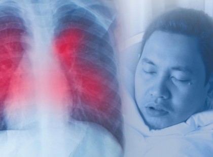 1310-re nőtt a koronavírus-fertőzöttek száma, elhunyt újabb 8 beteg.ITT a térkép – mutatjuk melyik megyékben ugrott meg a betegek száma!