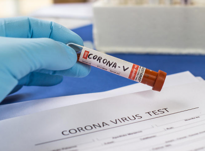 Május 1-től indul a tömegtesztelés Magyarországon! Őket fogják tesztelni