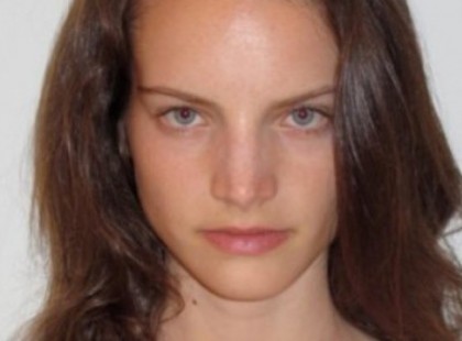 Atyaég! Ez a 18 Éves Lány 8 Hónapig CSAK Napi 3 Almán Élt. Nézd Meg, Mi Történt a Testével…