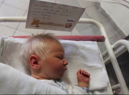 Szenzáció: Hófehér hajjal született egy magyar kisfiú