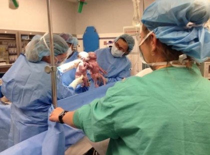 A friss anyuka hallja, hogy az orvosok zihálnak a szülőszobában. Aztán megnézi közelebbről a babáit, és rájön, hogy mi történt