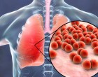 A 2. vírushullám előtt, ez a leghasznosabb, amit olvashatsz!!! LÉTFONTOSSÁGÚ információ! 2 vitamin, amik bizonyítottan erősítik az immunrendszert – Ennyit érdemes bevenni belőle naponta! >> JÖN A 2. vírushullám!! >> Készülj rá már most!!