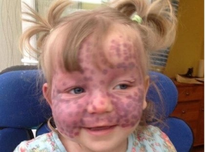 Kislányt állandóan gúnyolták !Szégyellheti magát, aki gúnyolódik, vagy nevet rajta! Amikor az anya elmondja miért néz ki így a kislánya...