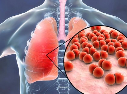 A 2. vírushullám előtt, ez a leghasznosabb, amit olvashatsz!!! LÉTFONTOSSÁGÚ információ! 2 vitamin, amik bizonyítottan erősítik az immunrendszert – Ennyit érdemes bevenni belőle naponta! >> JÖN A 2. vírushullám!! >> Készülj rá már most!!