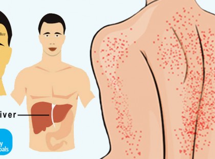 Ezzel a 15 jellel sikít a májad, hogy nagy a baj! Ne károsítsd tovább