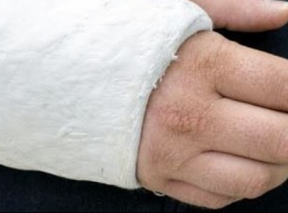 Nem volt maszkja ezért a biztonsági őr eltörte a csuklóját az 56 éves nőnek !