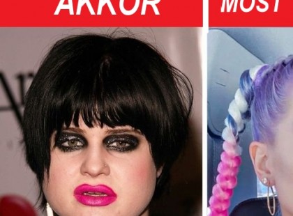 13 híresség, akik brutális átalakításon estek át