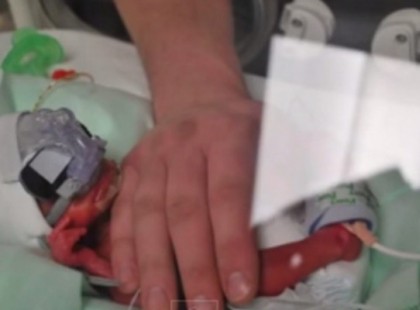 Nagyon koraszülött volt 27.hetesen született....de amikor a nővér meglátta, mennyire szenved, olyant tett, amire más nem lett volna képes!