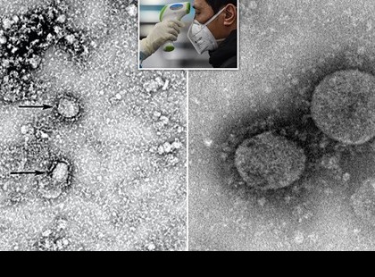 Világelső - magyar tudósoknak sikerült élő koronavírust megvizsgálniuk!Félelmetes dolgot találtak, ember ilyet még nem látott