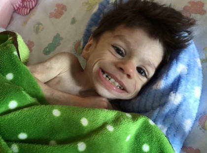 A 7 éves fiú csak 3,6 kg volt mikor kihozták az otthonból – nézd meg hogy néz ki egy év múlva