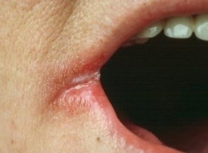 NE JÁTSSZ AZ ÉLETEDDEL! EZEKET A TÜNETEKET ÉSZLELTED? VALAMI NAGYON ROSSZRA UTALHATNAK!