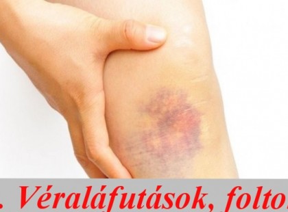 10+1 korai jele annak, hogy rákos vagy