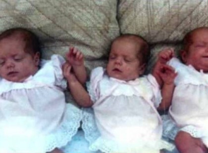 Szívszorító – Így néznek ki a 17 hónaposan, tűzben megégett hármas ikrek felnőttként