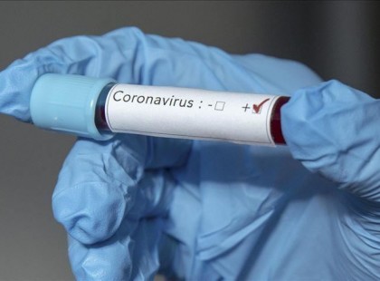 HIHETETLEN DE IGAZ! A legújabb kutatások szerint ŐK okozták a koronavírus járványt Magyarországon! >>>