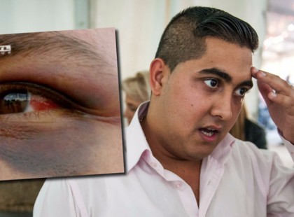 Rossz hírek! Kis Grófo az ájulás szélére került a koronavírustól