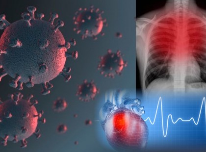 ALIG 20 perce jött a hír! Ettől félt minden magyar! Olyat jelentett be a magyar immunológus a koronavírusról, hogy a hideg rázott ki tőle….és ez bizony Önt is érinti!